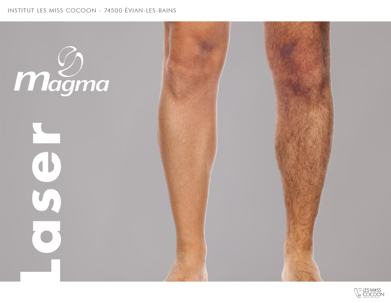 Laser Hommes Demi Jambes – Image 1